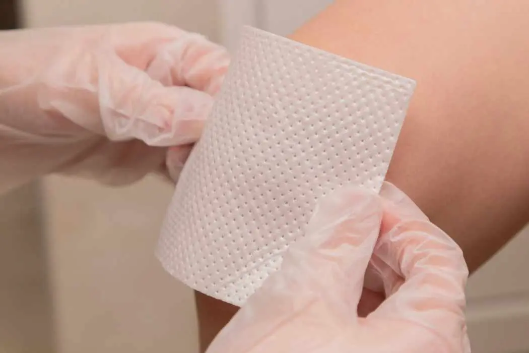Doctor bandaging a wound after signs of an infected wound.